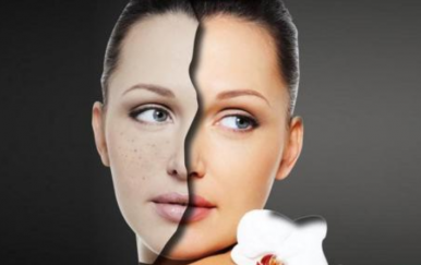 簡單的祛痘方法，讓你的皮膚時刻光滑細嫩